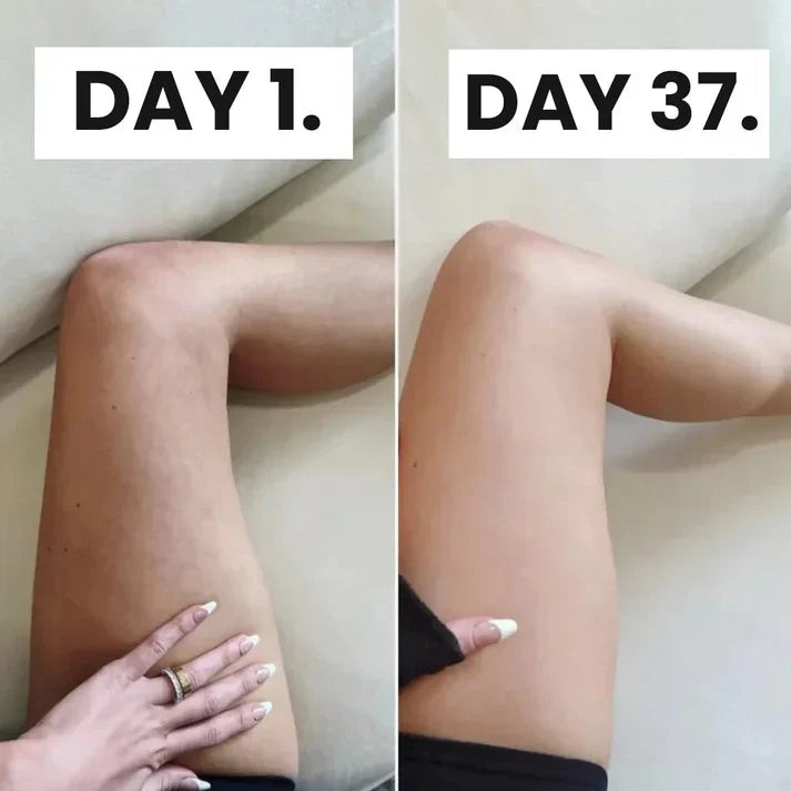 Anti-cellulite Massager