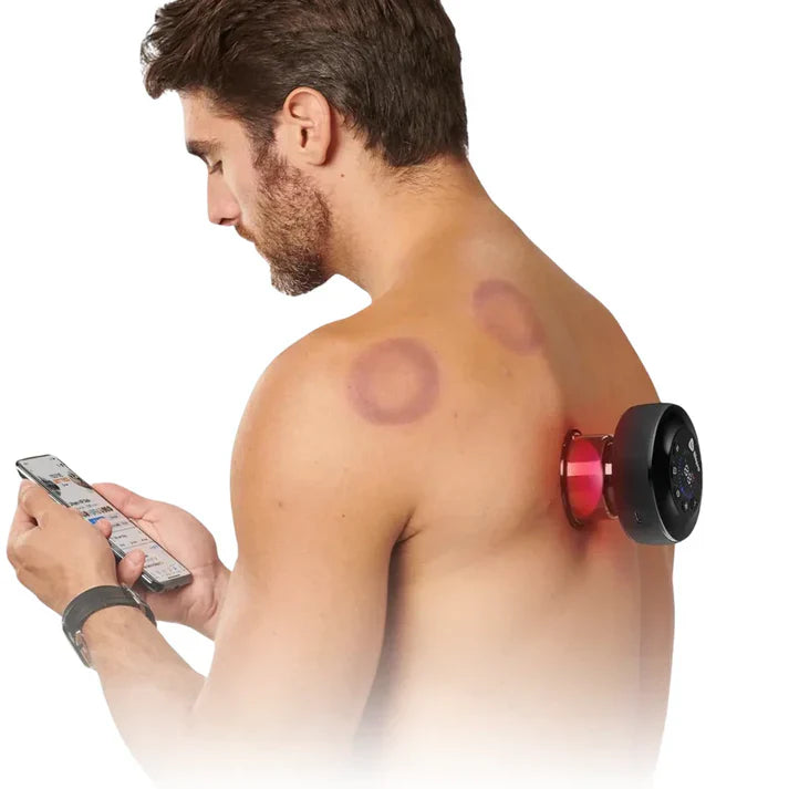 Premium Smart Cupping Massager